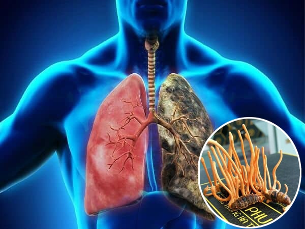 Tác dụng của đông trùng hạ thảo với bệnh phổi có TỐT không?
